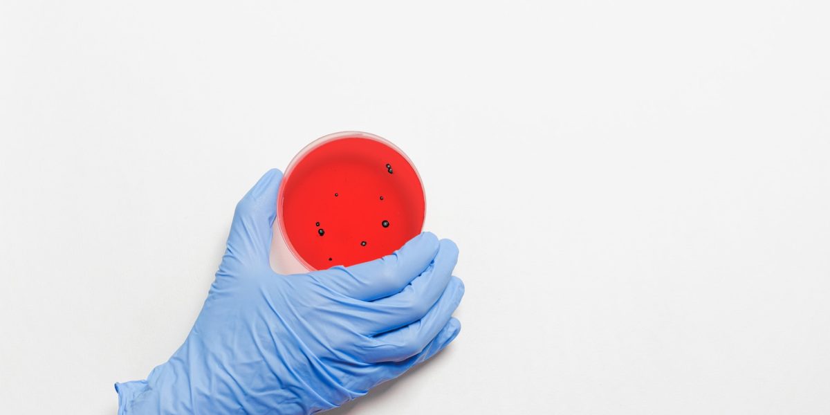 Die Rolle des Mikrobioms für Fertilität und Implantation